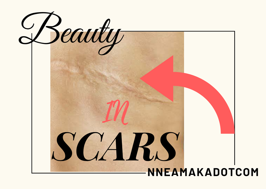 Beauty in scars